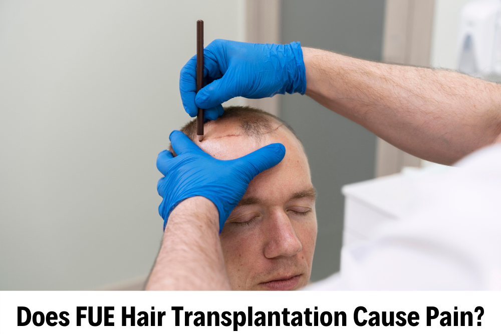 Sapphire Fue Hair Transplantation